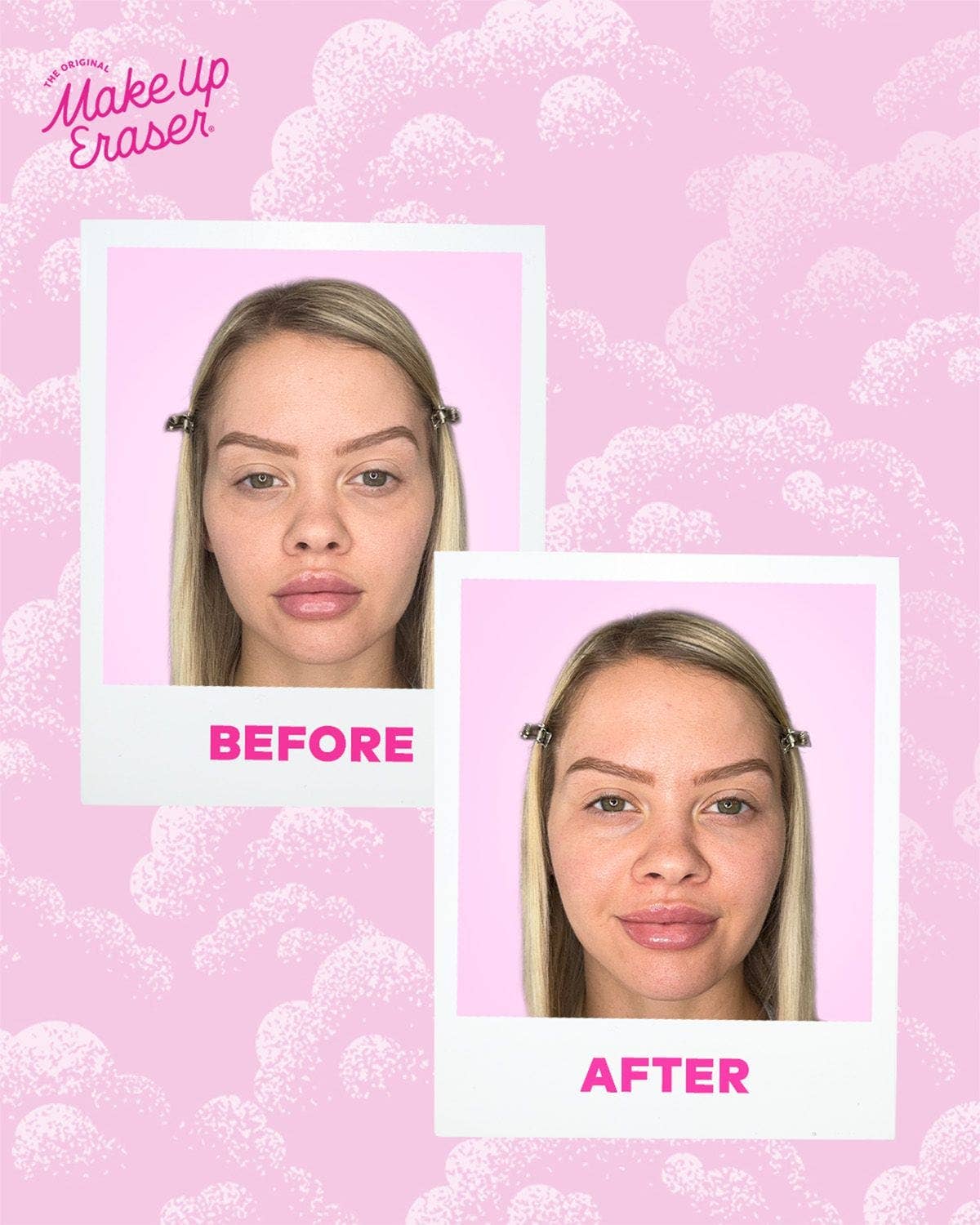 Cooling Clouds® Reusable Undereye Patches